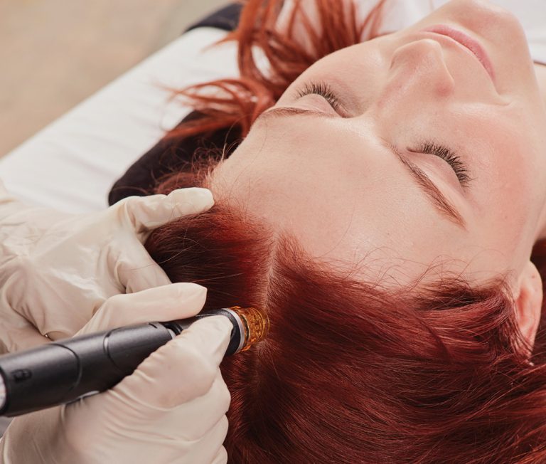 hydra Keravive 3 &bull; Hydrafacial Kopfhaut